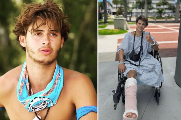 Survivor'da bacağını kaybeden yarışmacıdan yeni paylaşım: Yeni hayatına alışmaya çalışıyor