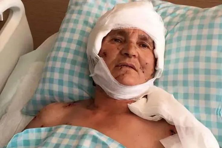 Yaşlı kadın evinin önünde dehşeti yaşadı: Yargıtay'dan köpek saldırısında emsal karar