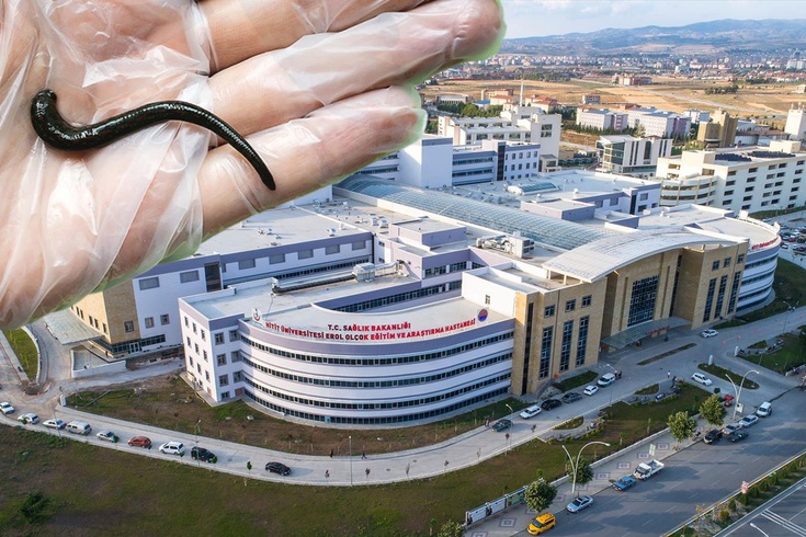 Çorum'da hastanın boğazından canlı sülük çıkarıldı! Köy çeşmesinden su içmiş