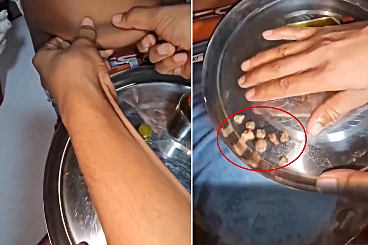 “Böbrek taşı döküyor” dendi! Yaptığı numara kısa sürede anlaşıldı