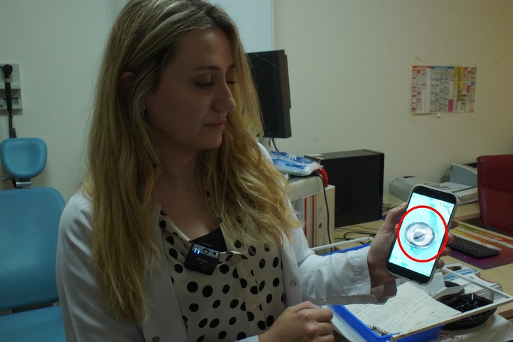 Tekrarlayan burun kanamasının nedeni şaşırttı! 10 yaşındaki çocuğun boğazından canlı sülük çıkarıldı