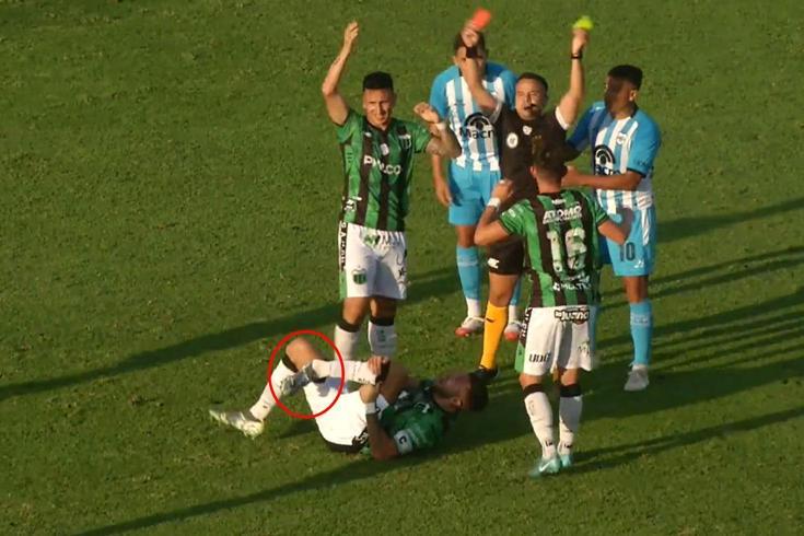 Genç futbolcunun kariyerini bitiren faul