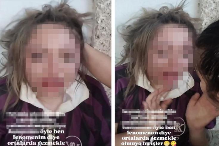 Genç kızı darp edip özür dilettiler, o anları sosyal medyada paylaştılar