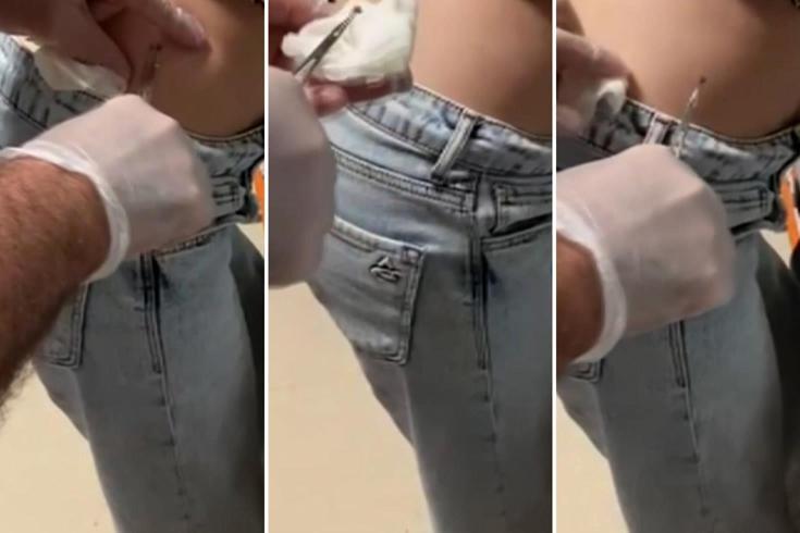 Talihsiz kadının korku dolu anları! Sivilce sandı ama yakından bakınca hastaneye koştu