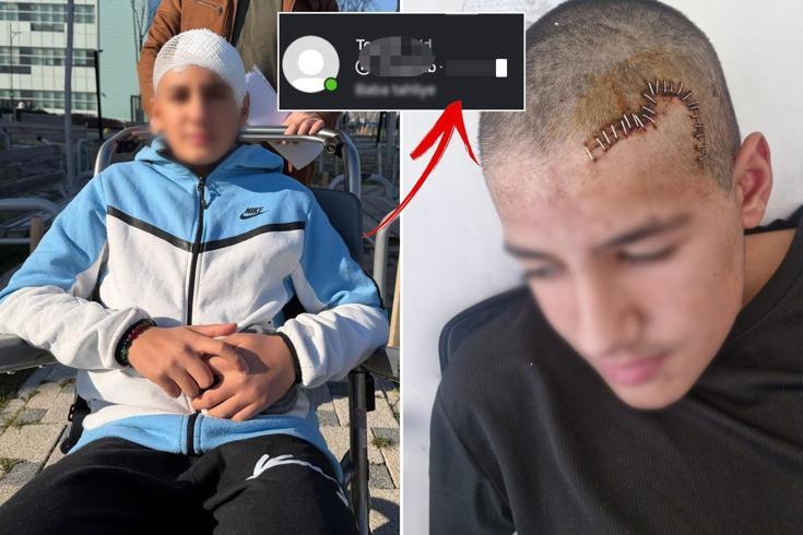 Okul arkadaşı taşla kafasını parçaladı! Tahliye edilen çocuğun paylaşımı çıldırttı