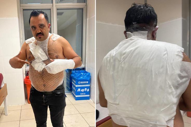 Deney yapmak isterken hayatının hatasını yaptı