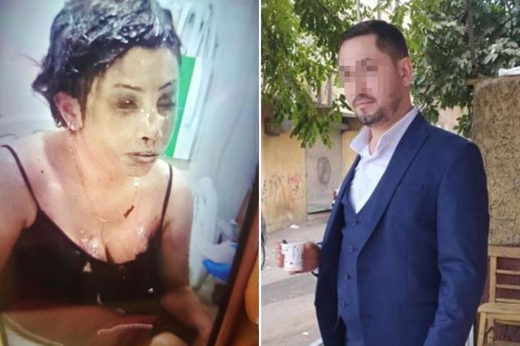 Bunun adı saf kötülük! Eşini koli bandıyla bağlayıp kezzapla yaktı