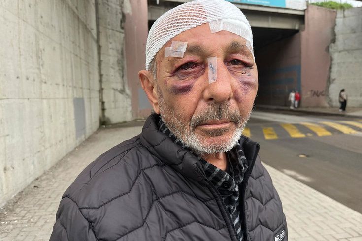 Çakmak istediler verdi, sonrasında bu hale geldi