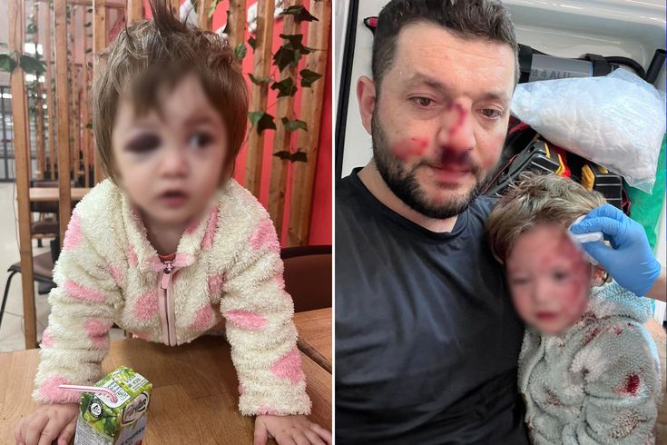 İşte 14 aylık İkra bebeği hastanelik edenlere istenen ceza! Skuter silah sayıldı