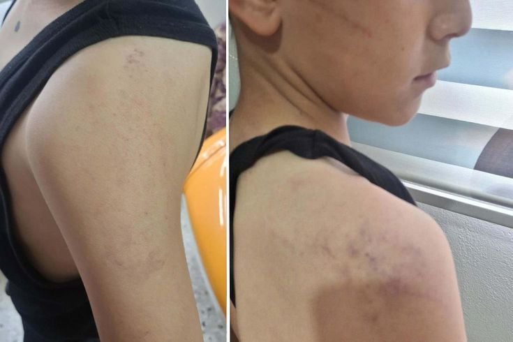 Babasının, öğretmeninden harçlık istedi diye darbettiği çocuk devlet korumasına alındı