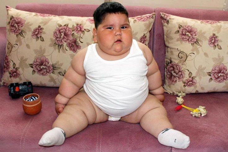 5 yaşındayken 90 kiloydu! Minik Yağız'ın 6 yıl sonraki halini görenler inanamıyor