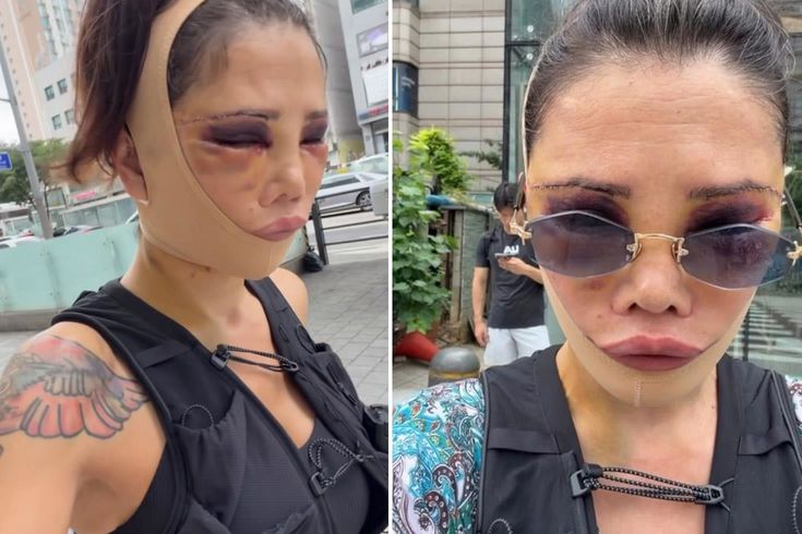 Eski Survivor yıldızı Didem Ceran tanınmaz halde