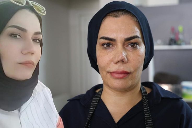 Burun estetiği faciayla sonuçlandı: Kadının hayatı kabusa döndü