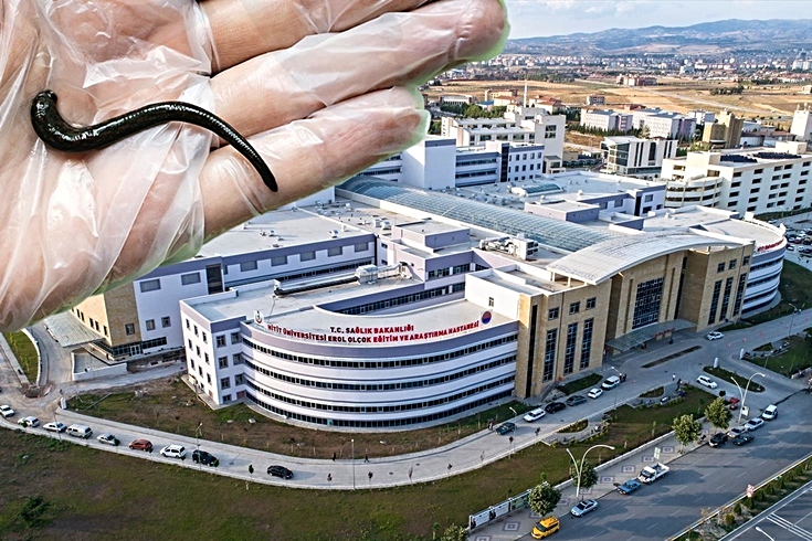 Çorum'da hastanın boğazından canlı sülük çıkarıldı! Köy çeşmesinden su içmiş