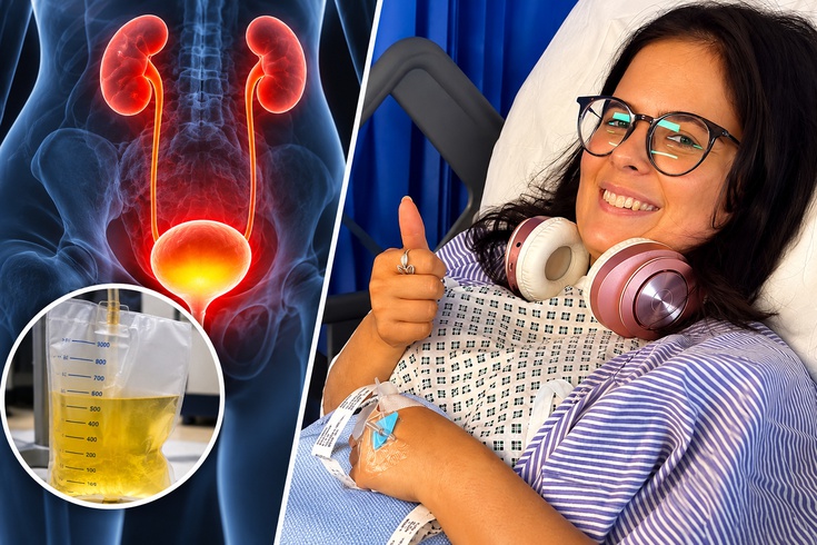 2,5 yıldır normal şekilde idrar yapamıyor: Mesanesinden 1 litre idrar boşaltıldı