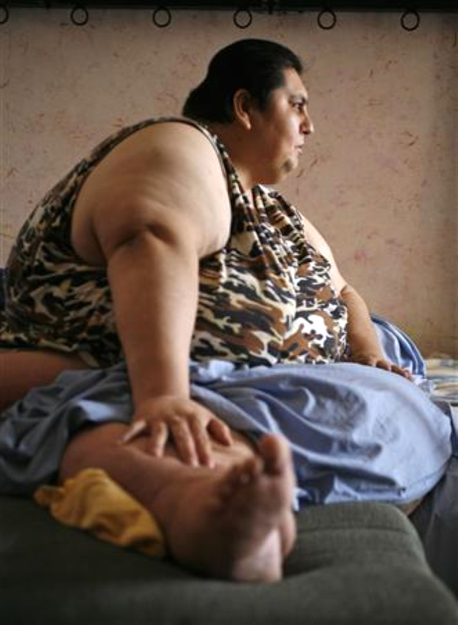 Тетя очень хочет. Мануэль Урибе самый толстый человек в мире. Мексиканец Мануэль Урибе.
