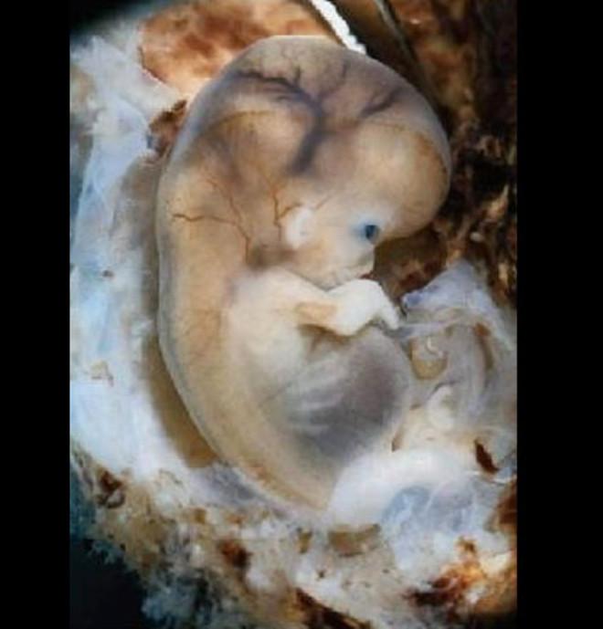 Bir Yaşındaki Kız Bebek Hamile Foto Galerisi