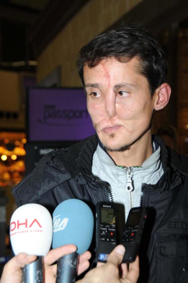 Recep Yüz Nakli Umuduyla İçin İkinci Kez Antalya Yolunda