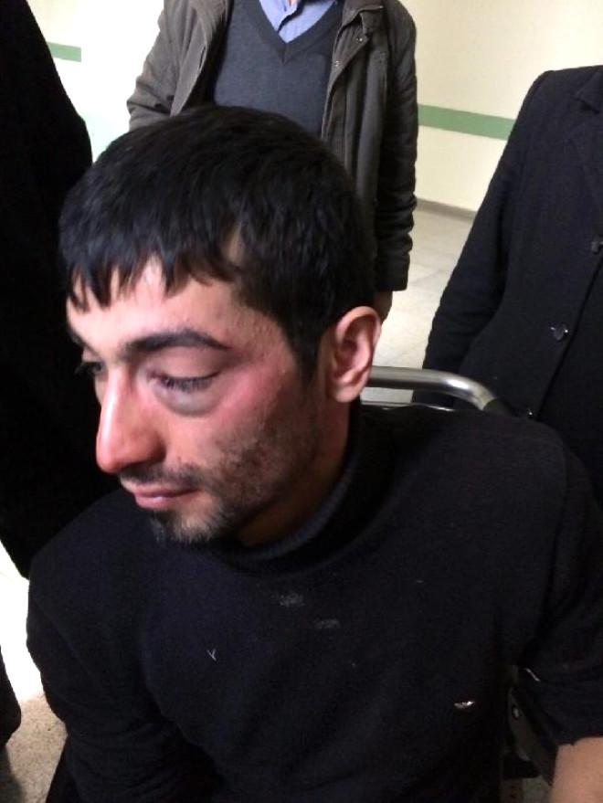 Polisin, Tarihi Geçmiş Gaz Bombası Kullandığı İddiası