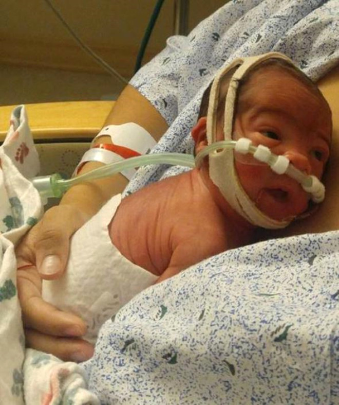 Hastaneye Yetişemeyince Arabada Doğum Yaptı