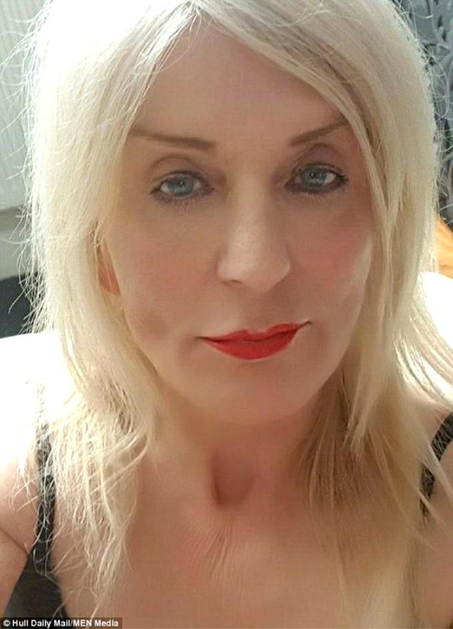 Trans Birey Piyangodan Çıkan Parayı Estetiğe Harcadı! Son Haliyle Şoke Etti