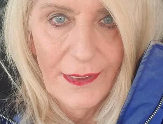 Trans Birey Piyangodan Çıkan Parayı Estetiğe Harcadı! Son Haliyle Şoke Etti