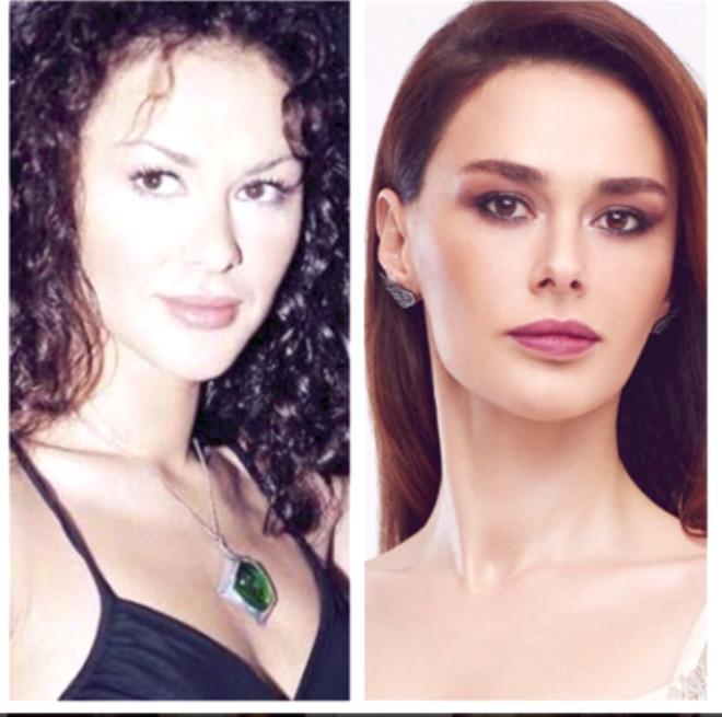 estetiksiz hali burcu önal eşi