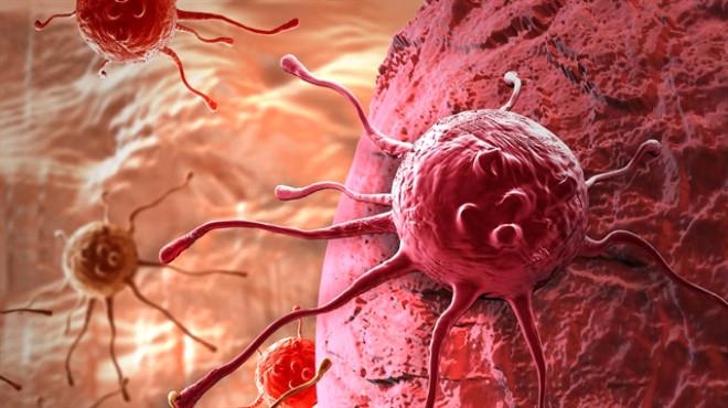 Dünya Sağlık Örgütü, 2018'de Tahmini 9,6 Milyon Kişinin Kanserden Öleceğini Duyurdu