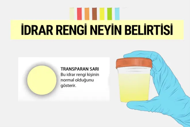 İDRAR RENGİNİZ BORDO İSE DİKKAT! KÖTÜ HASTALIĞIN HABERCİSİ OLABİLİR