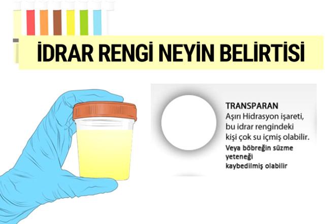İDRAR RENGİNİZ BORDO İSE DİKKAT! KÖTÜ HASTALIĞIN HABERCİSİ OLABİLİR