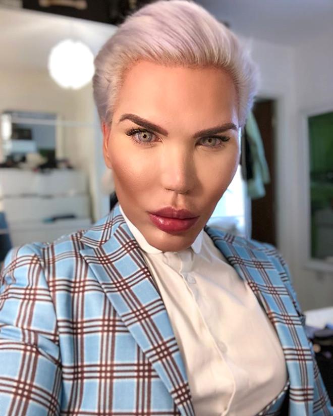 Rodrigo Alves Oyuncak Bebek Ken E Benzemek Icin Yeniden Bicak Altina Yatti Foto Galerisi