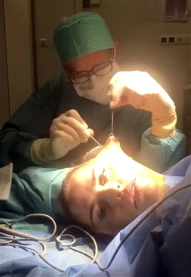 Yüz Gerdirme Operasyonu Sırasında O Anları Kaydeden Ünlü Şarkıcının Son Hali Şaşırttı!