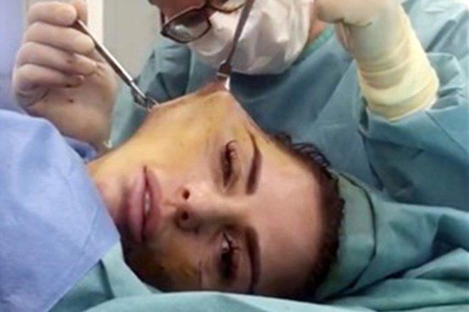 Yüz Gerdirme Operasyonu Sırasında O Anları Kaydeden Ünlü Şarkıcının Son Hali Şaşırttı!