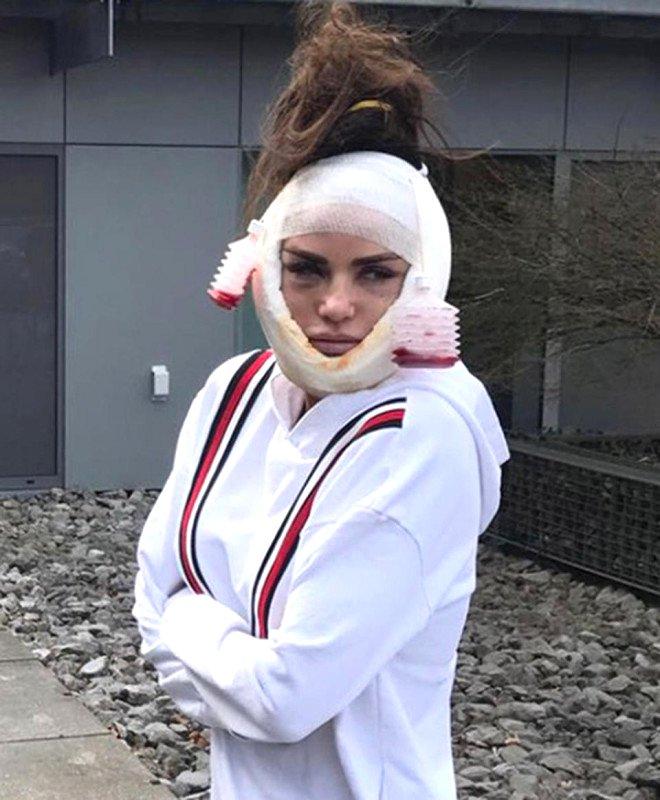 Yüz Gerdirme Operasyonu Sırasında O Anları Kaydeden Ünlü Şarkıcının Son Hali Şaşırttı!