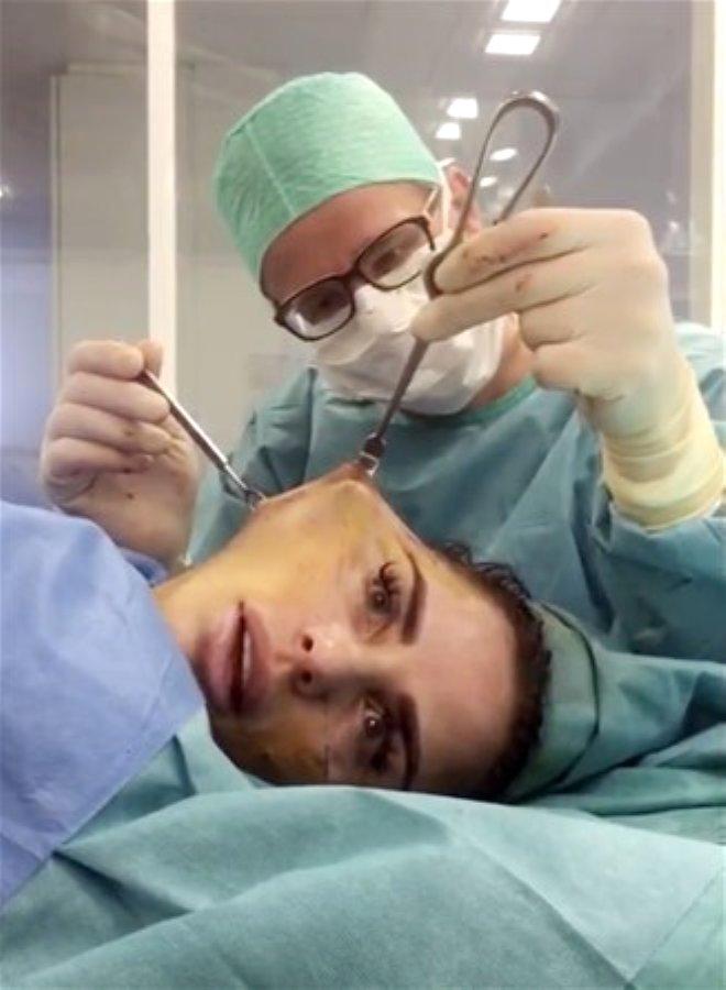 Yüz Gerdirme Operasyonu Sırasında O Anları Kaydeden Ünlü Şarkıcının Son Hali Şaşırttı!