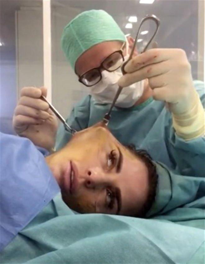 Yüz Gerdirme Operasyonu Sırasında O Anları Kaydeden Ünlü Şarkıcının Son Hali Şaşırttı!