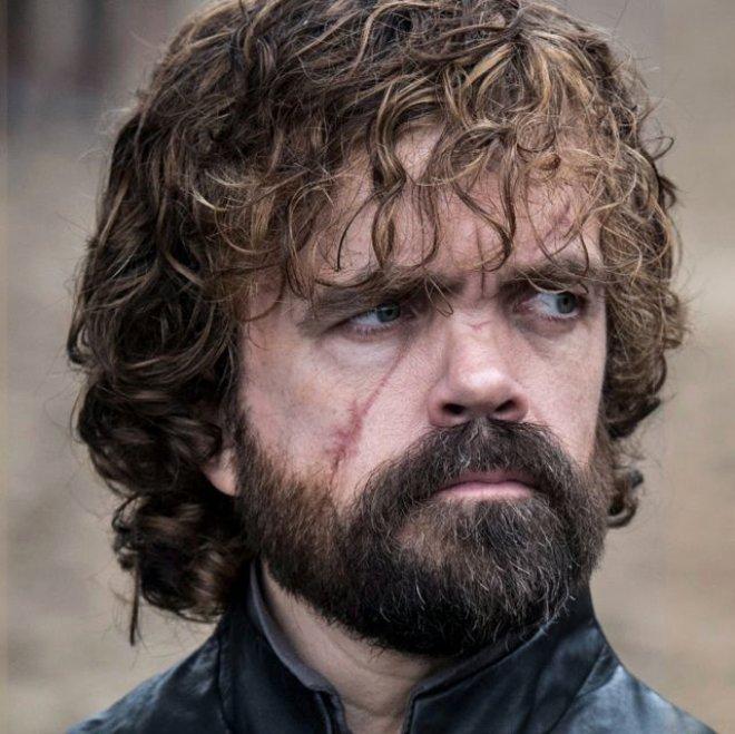 Game Of Thrones Yıldızının İkizi, Garson Çıktı!