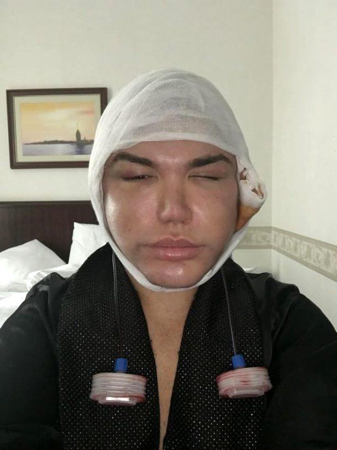 70. kez bıçak altına yattı! Estetik bağımlısı Ken Bebek'in son hali korkuttu