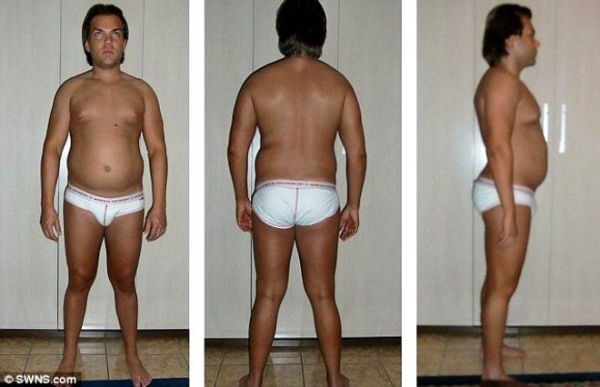 70. kez bıçak altına yattı! Estetik bağımlısı Ken Bebek'in son hali korkuttu
