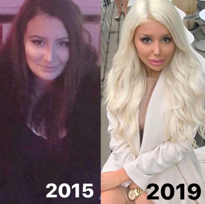 Her şey Barbie'ye benzemek için! Estetik operasyonlara yılda 104 bin TL harcıyor
