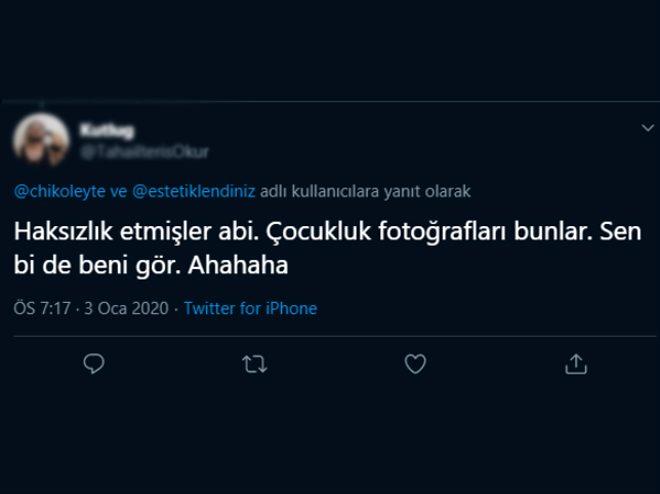 Acun Ilıcalı'nın 20'lik sevgilisi Çağla Altunkaya'nın estetiksiz hali Twitter'ı salladı