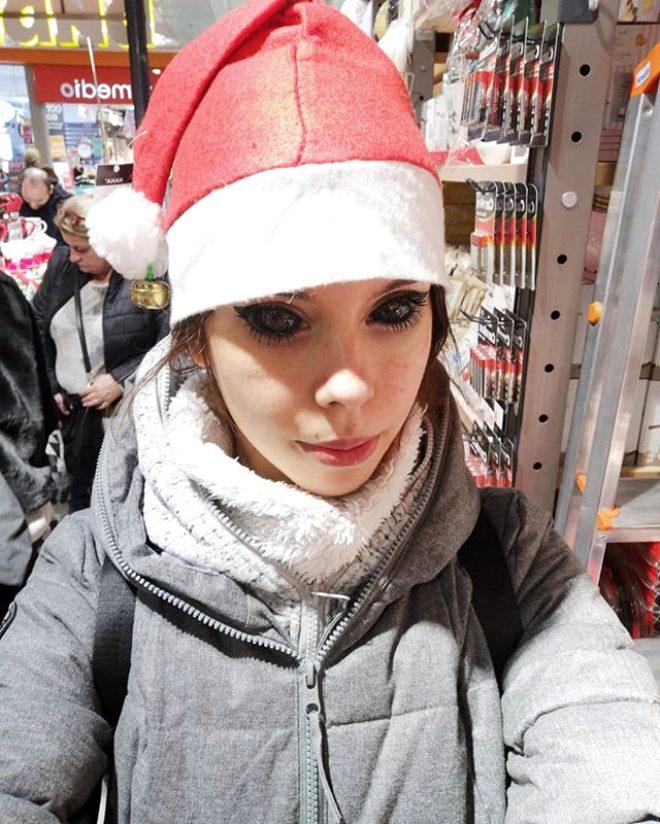 Hayranı olduğu şarkıcıya özenip gözlerine dövme yaptıran 25 yaşındaki genç kız kör oldu!.