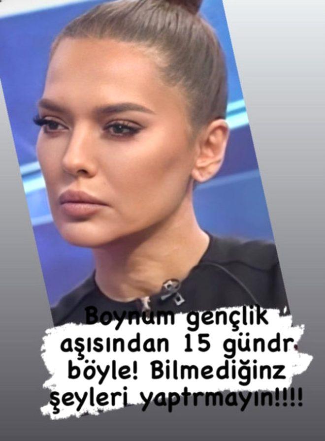 Güzelleşeyim derken sağlığından oldu! Estetik mağduru Akalın'ın boynu herkesi korkuttu