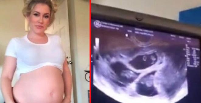 İkizlere hamile olan fenomen, 10 gün sonra tekrar hamile kaldı! Şimdi üçüz bebek bekliyor