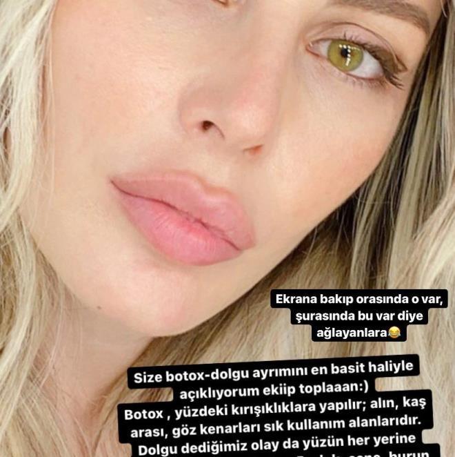 Kalça dansı sonrası işinden olan Hande Sarıoğlu estetiklerini itiraf etti! Bakın eski hali nasılmış