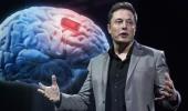 Elon Musk'ın gelecek projesi: Neuralink