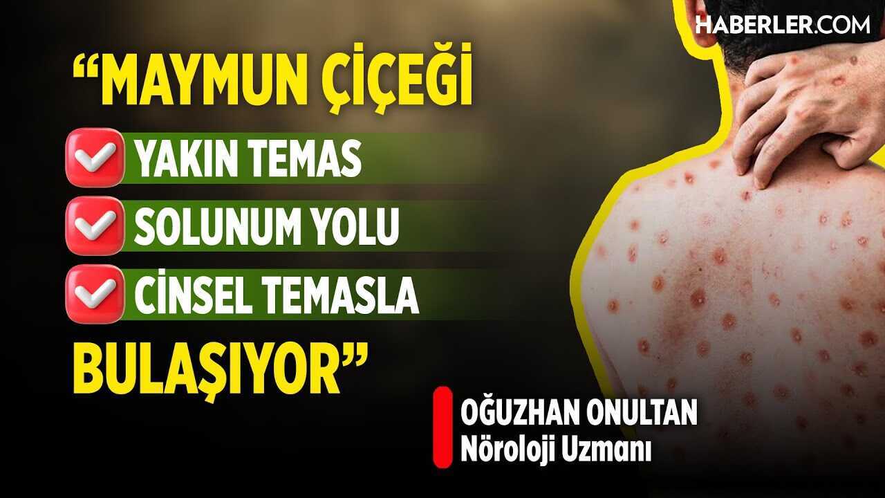 https://foto.haberler.com/genel/youtube/maymun-cicegi-covid-kadar-olumcul-bir-hastalik-6885ab99879e.jpg