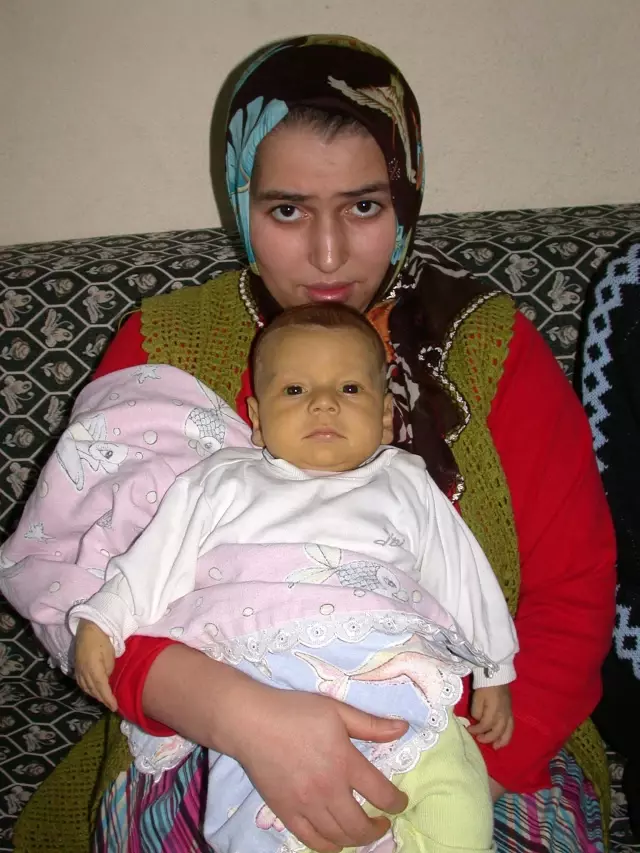 Safra Kesesisiz Doğan Berkay Bebek, Karaciğer Nakli