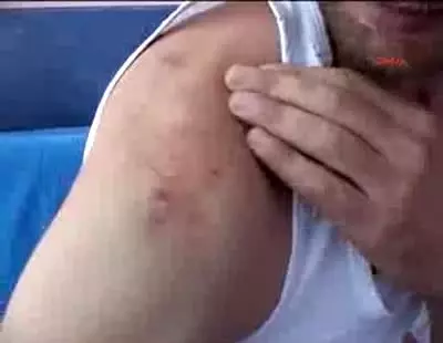 Aile Hekimi Tarafından Hastanelik Edildiler Aile Hekimi Tarafından Hastanelik Edildiler