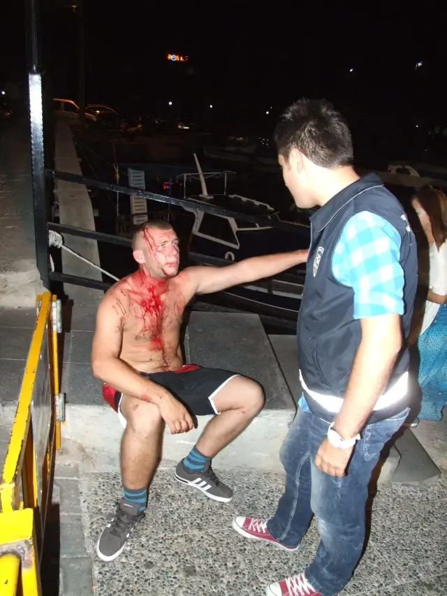 Başına Şişeyle Vurulan İngiliz Turist Şikayetçi Olmadı Başına Şişeyle Vurulan İngiliz Turist Şikayetçi Olmadı